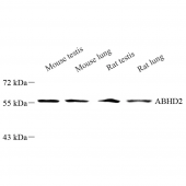 Anti -ABHD2 Rabbit pAb