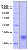 Recombinant Human Alpha-synuclein/SNCA Protein (RP00610)