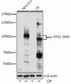 Phospho-GYS1-S641 Antibody kit (RK05792)