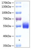 Recombinant Human TNFRSF14/HVEM/CD270 Protein (RP00070)