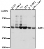 [One Step]DARS Antibody Kit (RK05641)