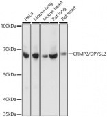[KO Validated] CRMP2/DPYSL2 Rabbit mAb (A4411)