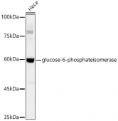 [KD Validated] glucose-6-phosphate isomerase Rabbit mAb (A4401)