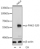 Phospho-PAK2-S20 Antibody kit (RK05767)