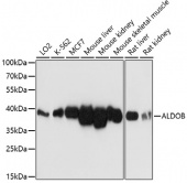 [One Step]ALDOB Antibody Kit (RK05622)