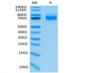 Recombinant Human IL-7RA/CD127 Protein (RP02408)