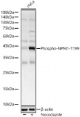 Phospho-NPM1-T199 Antibody kit (RK05773)