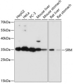[One Step] SRM antibody Kit (RK05732)