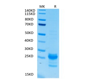Biotinylated Recombinant Human IL-17A/CTLA-8 Protein (RP02410)