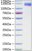 Recombinant Mouse SELE/E-selectin/CD62E  Protein (RP01077)