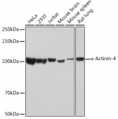 α-Actinin-4 Rabbit mAb (A3379)