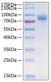 Active Recombinant Human CSF1R/M-CSF R/CD115 Protein (RP00268)