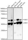[KD Validated] JNK1 Rabbit mAb (A21888)