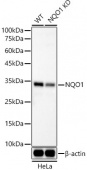 [KD Validated] NQO1 Rabbit mAb (A22290)