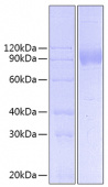 Recombinant Human IL-17RA/CD217 Protein (RP00916)