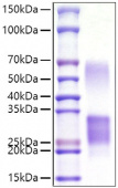 Recombinant Mouse CD69 Protein (RP01508)