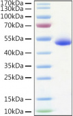 Recombinant Human TNFRSF10B/DR5/TRAIL-R2 Protein (RP01388)