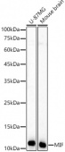 [KD Validated] MIF Rabbit pAb (A22682)