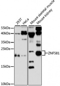 ZNF581 Rabbit pAb (A13162)