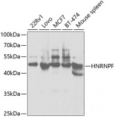[KO Validated] HNRNPF Rabbit pAb (A5505)