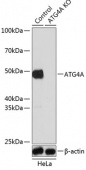[KO Validated] ATG4A Rabbit pAb (A19844)