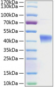 Recombinant Human IL-22RA2/IL22BP Protein (RP00192)
