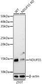 [KD Validated] NDUFS5 Rabbit pAb (A21504)