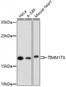 [One Step]TIMM17A Antibody Kit (RK05715)