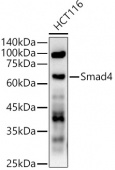 [KD Validated] Smad4 Rabbit pAb (A21487)