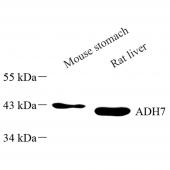 Anti -ADH7 Rabbit pAb