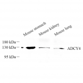 Anti -ADCY4 Rabbit pAb