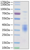Recombinant Human IL-12A Protein (RP01154)