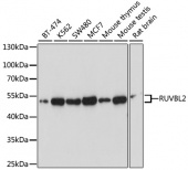 [One Step]RUVBL2 Antibody Kit (RK05706)