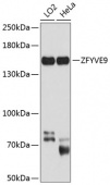 ZFYVE9 Rabbit pAb (A9041)