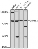 ZNF652 Rabbit pAb (A18657)