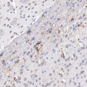 Anti -Adenylate cyclase 1/AC1 Rabbit pAb