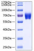 Recombinant Human Basigin/CD147 Protein (RP00104)