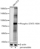Phospho-STAT5-Y694 Antibody kit (RK05783)