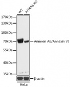 [KO Validated] Annexin A6/Annexin VI Rabbit pAb (A18069)