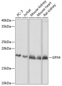[KD Validated] GPX4 Rabbit mAb (A11243)