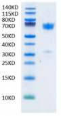 Recombinant Human B7-H1/PD-L1/CD274 Protein (RP02045)