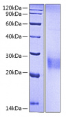 Recombinant Human KP43/CD94 Protein (RP00567)