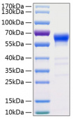 Active Recombinant Human FAS/APO-1/CD95 Protein (RP00139)