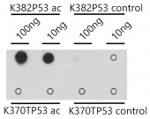 Acetyl-p53-K382 Rabbit pAb (A18663)