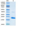 Recombinant Human TNF-alpha Protein (RP02080)