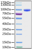 Recombinant Human CD177 Protein (RP01202)