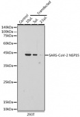 SARS-CoV-2 NSP15 Rabbit pAb (A20282)