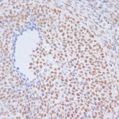 Acetyl-Histone H1.4-K26 Rabbit pAb (A17893)