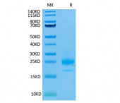 Biotinylated Recombinant Human TRAIL-R1/CD261 Protein (RP02083)