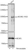 Phospho-BCAR1-Y410 Antibody kit (RK06012)